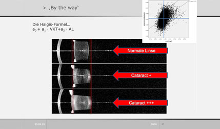 Modul Bild Diagnostik Biometrie für die Kataraktchirurgie at targolearn