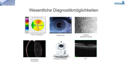 Modul Bild Torische Intraokularlinsen: Tipps u Tricks bei targolearn